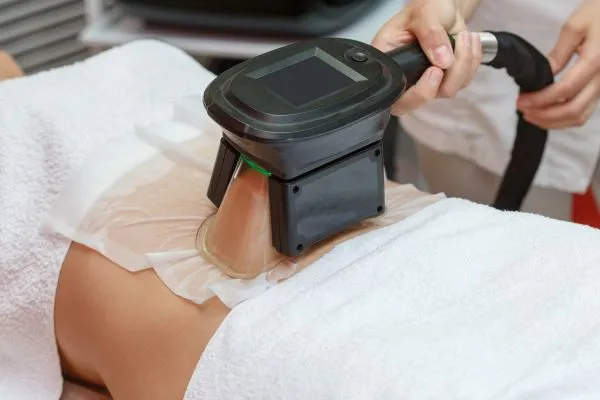 Image of person having fat freezing treatment to help weight gain Holme Chapel