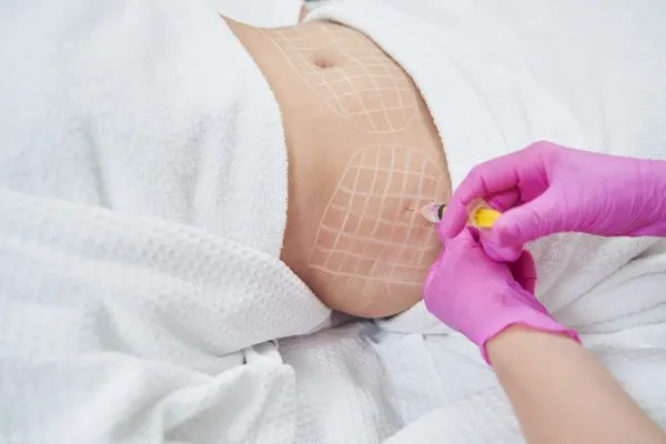image of fat dissolving injections on love handles to help combat weight gain Holme Chapel